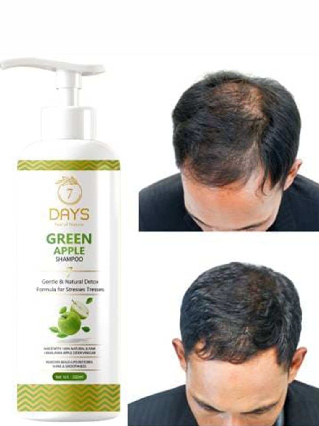 7 DAYS Green Apple Shampoo For Dandruff - 200ml