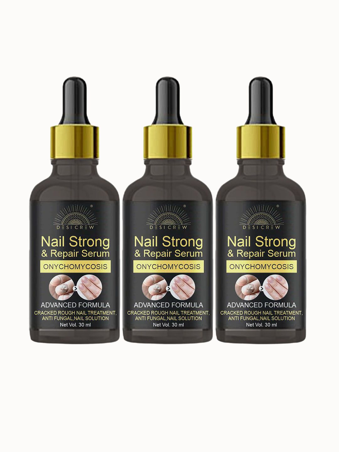 Desi Crew Set of 3 Onychomycosis Nail Strong & Repair Serum - 30 ml Each