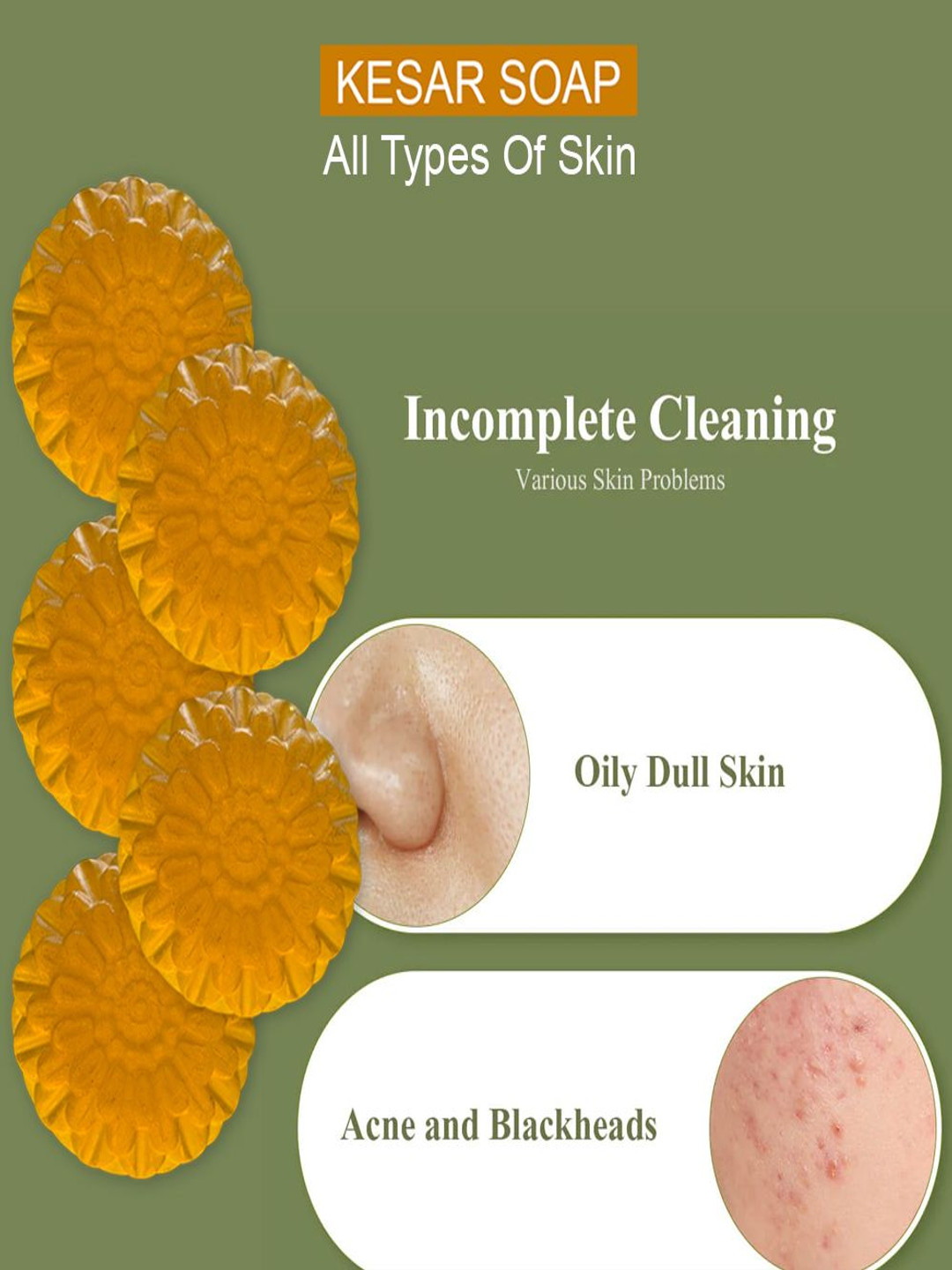 GROOVY Set Of 5 Cinnamon Spice Kesar Bar - 100 g Each