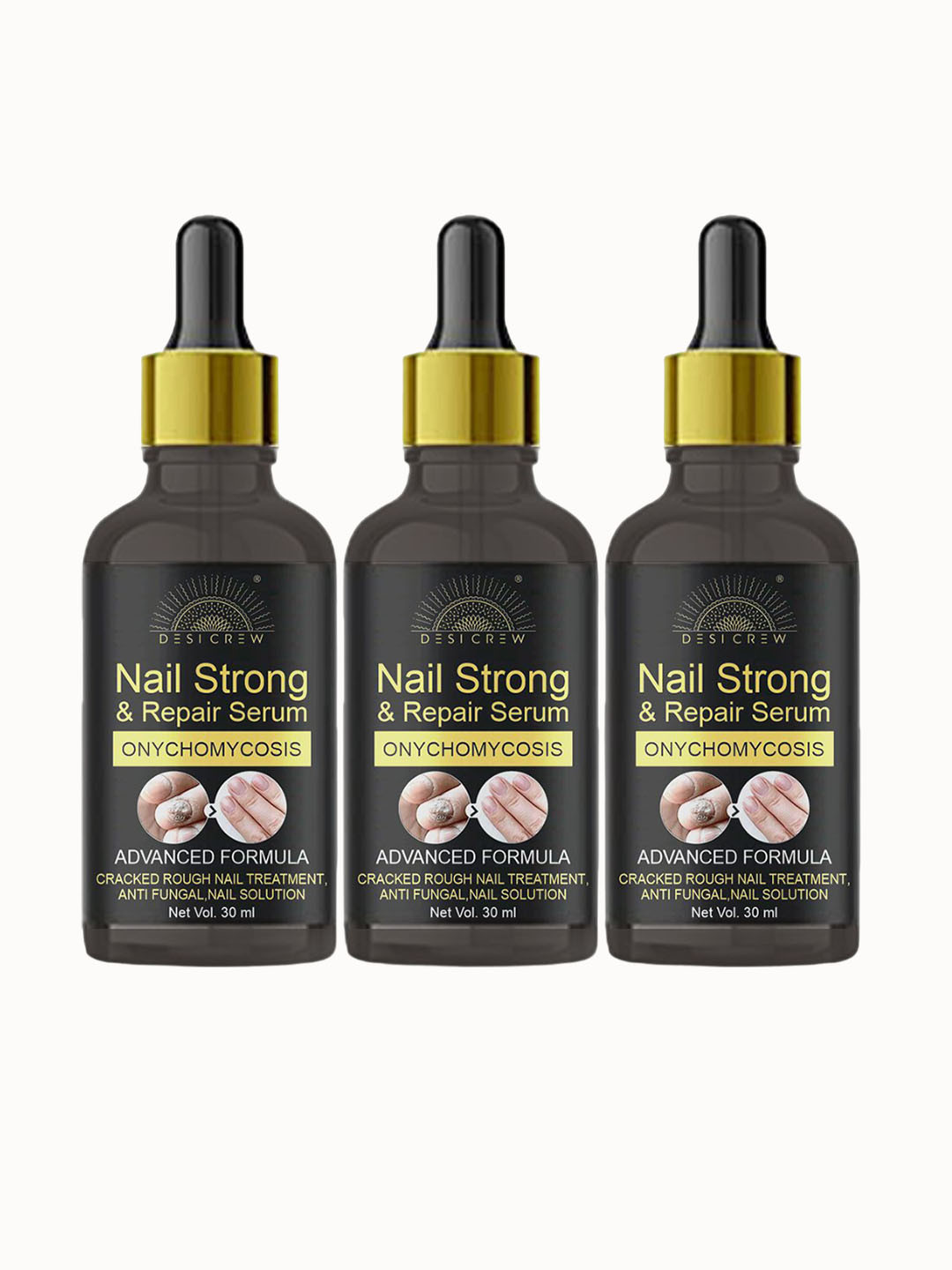 Desi Crew Set of 3 Onychomycosis Nail Strong & Repair Serum - 30 ml Each