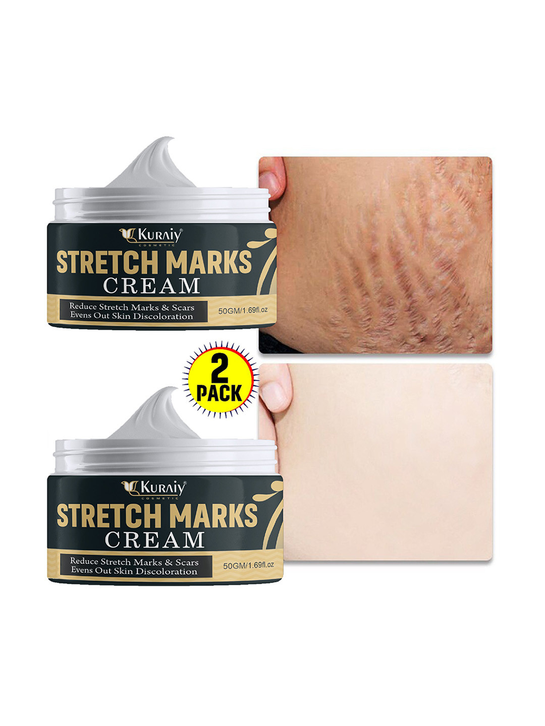KURAIY Set of 2 Stretch Marks Cream - Reduces Scars & Evens Out Skin - 50g each