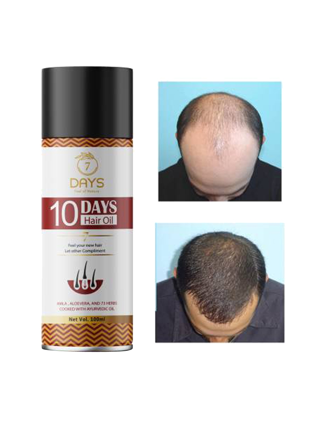 Buy 7 DAYS 10 Days Hair Oil For Hair Regrowth Hair Fall Control