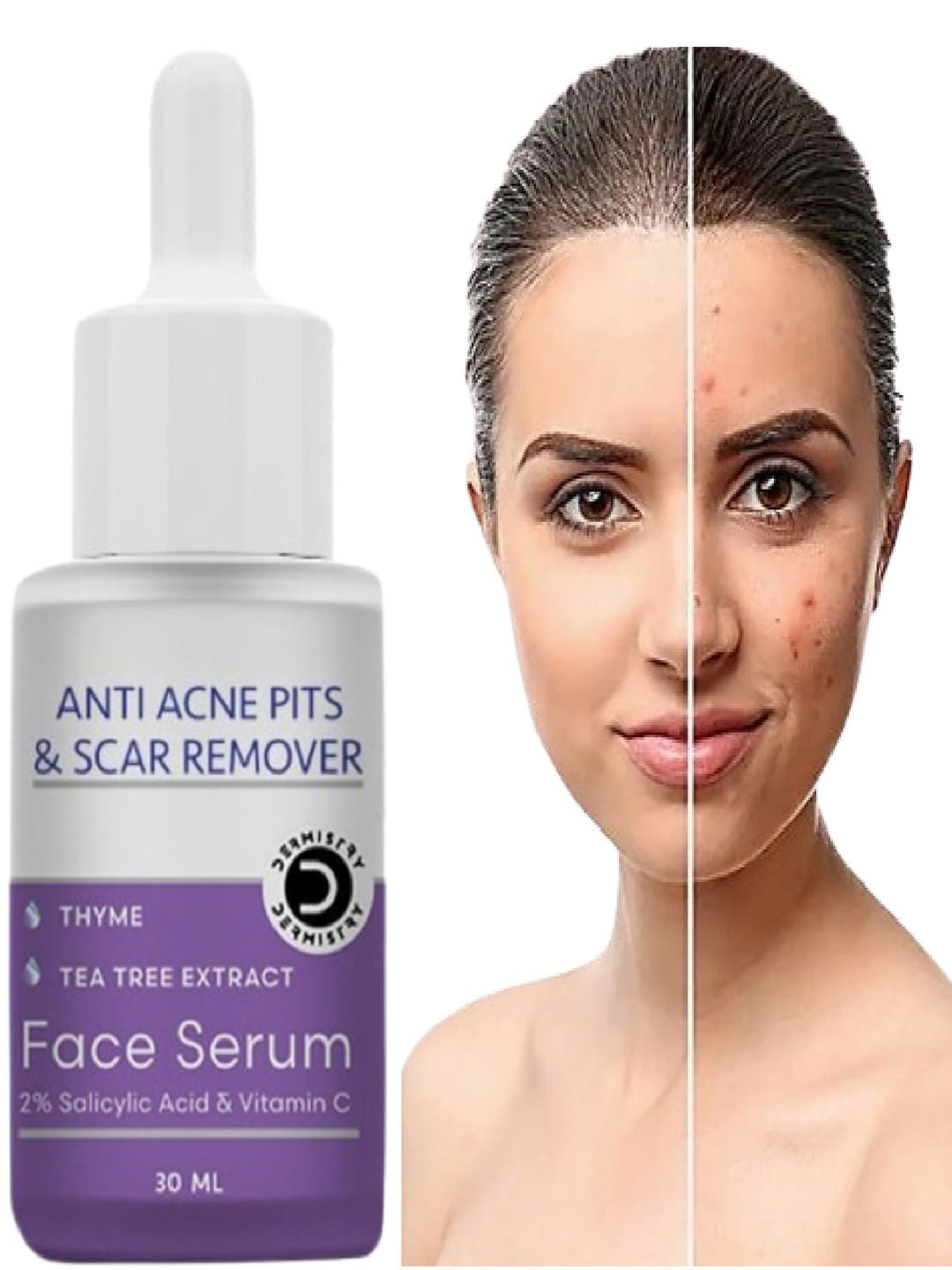 Vigini Dermistry Anti Acne Pits & Scar Remover Face Serum with Thyme & Tea Tree - 30 ml