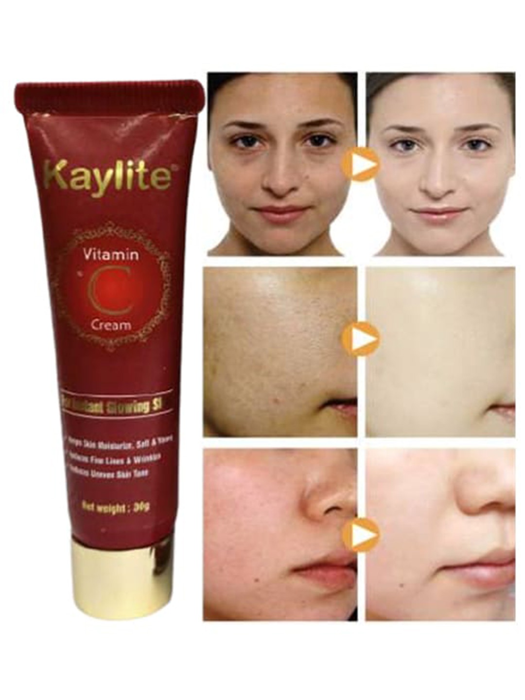 

Kaylite Set Of 4 Vitamin C Face Moisturizer Glowing Skin Cream 120gm, Red