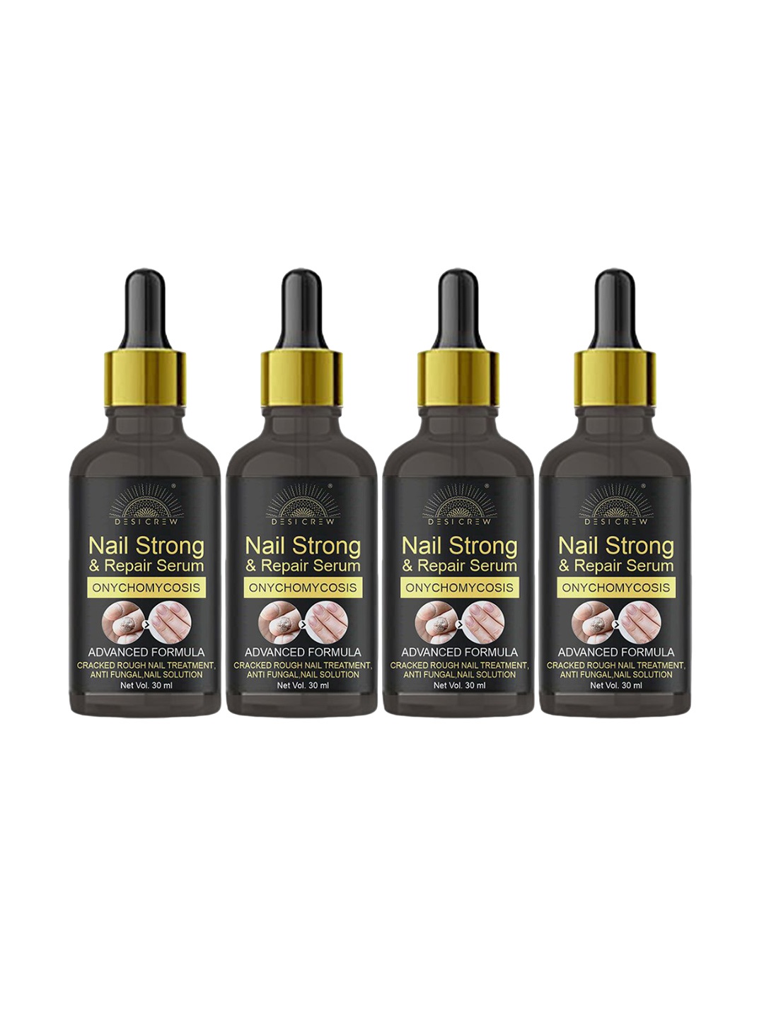 

Desi Crew Set of 4 Onychomycosis Nail Strong & Repair Serum - 30 ml Each, Yellow