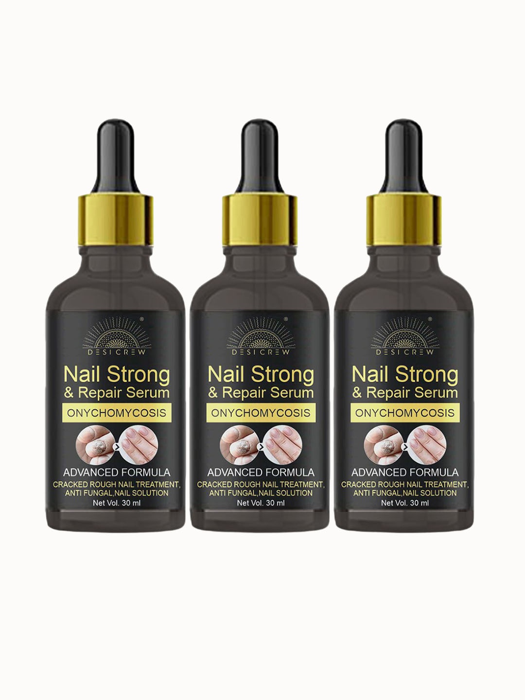 

Desi Crew Set of 3 Onychomycosis Nail Strong & Repair Serum - 30 ml Each, Yellow