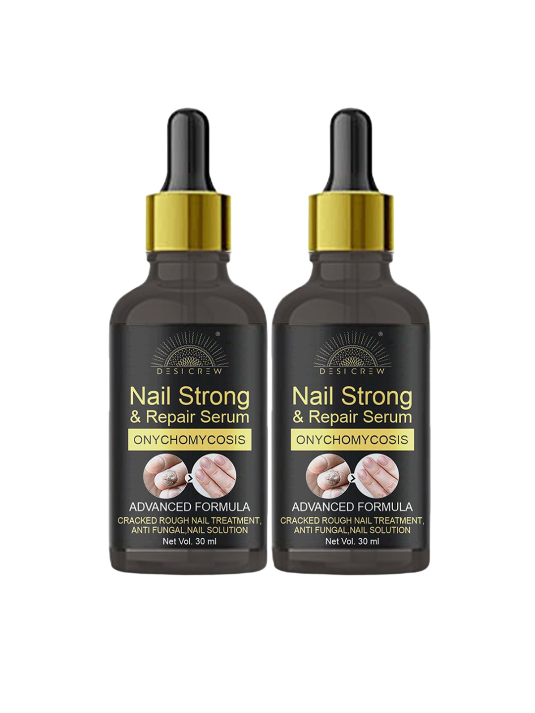 

Desi Crew Set of 2 Onychomycosis Nail Strong & Repair Serum - 30 ml Each, Yellow