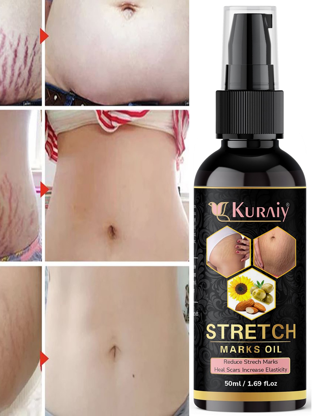 

KURAIY Natural Heal & Repair Pregnancy Stretch Marks Removal Oil - 50ml, Black