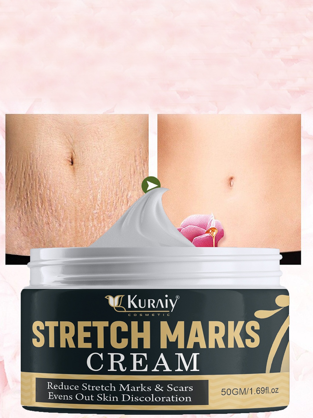 

KURAIY Maternity Stretch Marks Remover Treatment Cream - 50g, Black