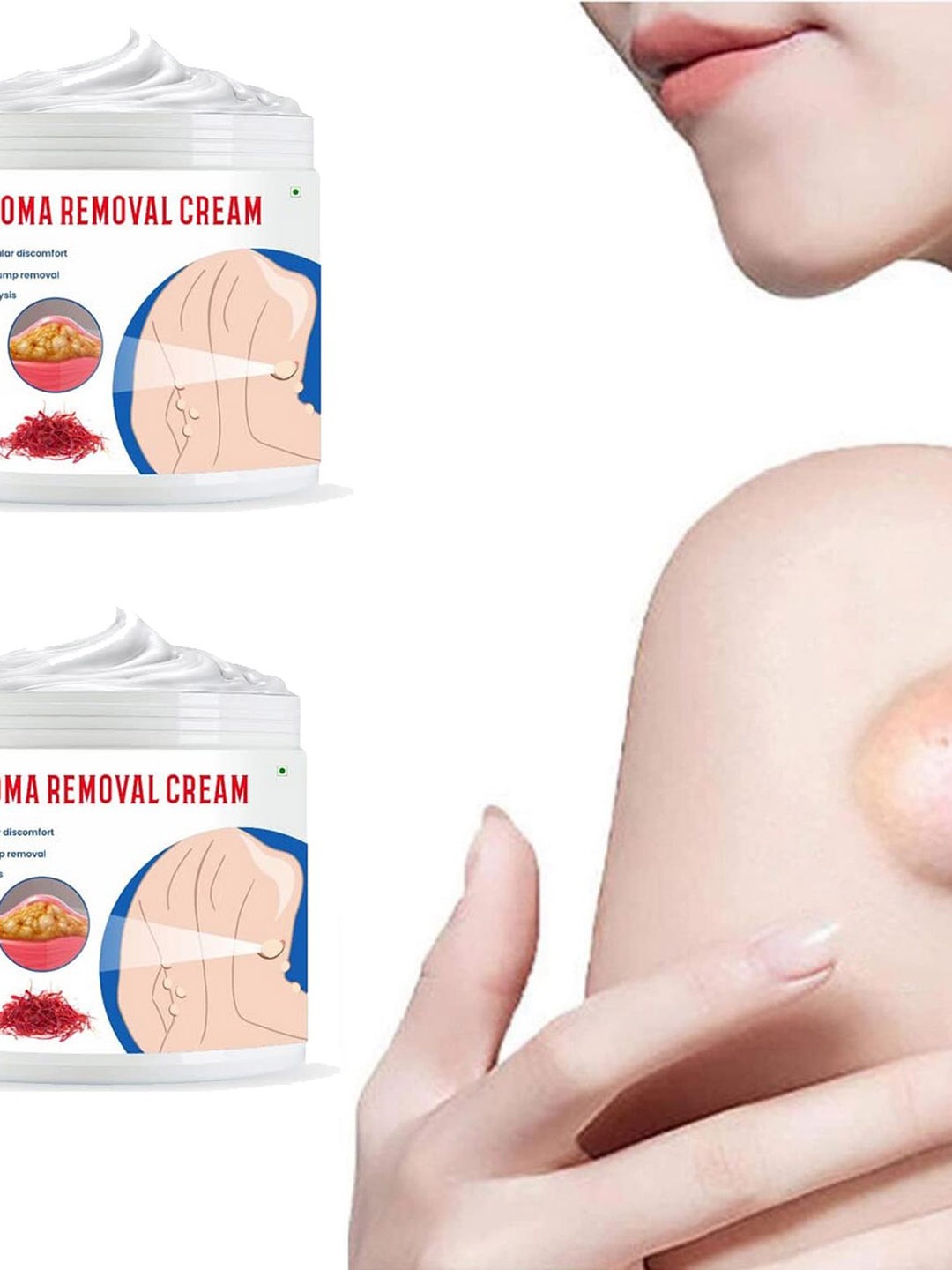 

Groovy Set Of 2 Lipoma Removal Cream -100gm Each, White