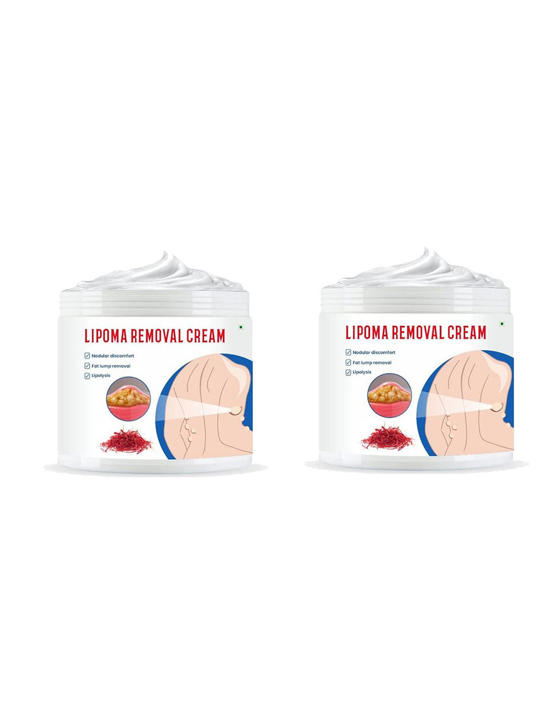 

Groovy Set Of 2 Lipoma Removal Cream - 100gm Each, White
