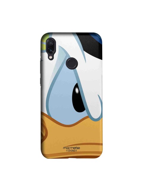 

macmerise White & Yellow Disney Zoom Up Dold Sublime Xiaomi Redmi Note 7 Back Cover