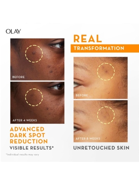 Olay Vitamin C Kit for 2X Glow with Serum 30ml & Cleanser 100g - Image 6