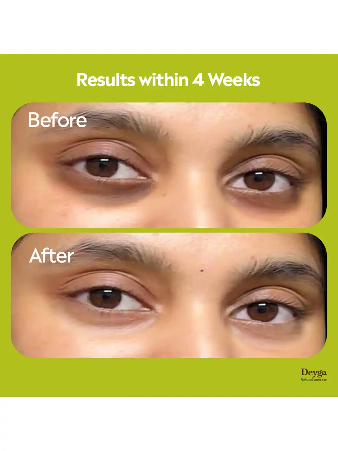 Buy Deyga Organics Under Eye Cream Reduces Dark Circles