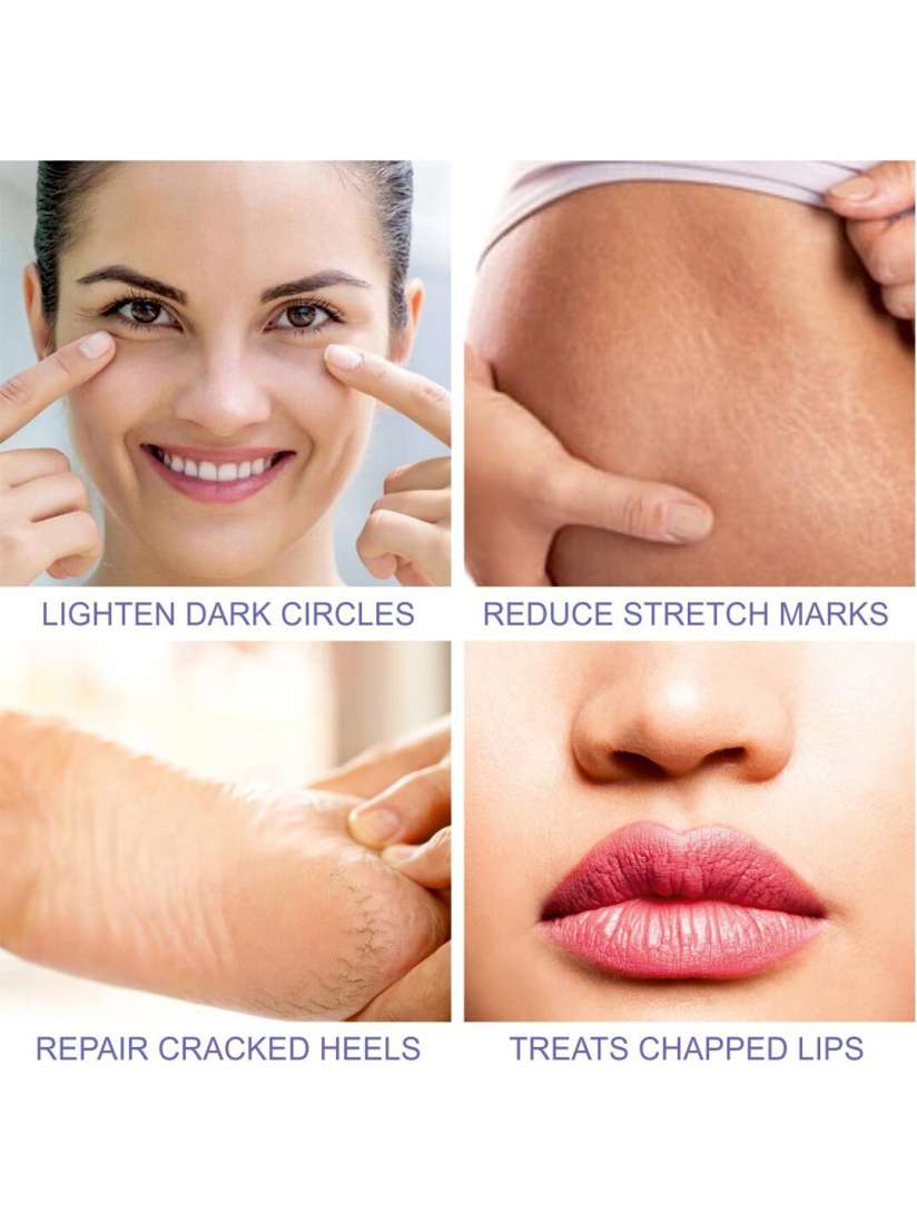 Vitamin e oil for cracked heels on sale